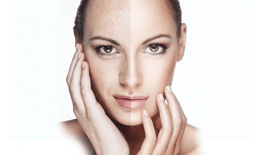 Hydroserum como se aplica